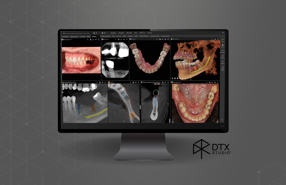 DX_CEDE workshop DTX StudioTM
